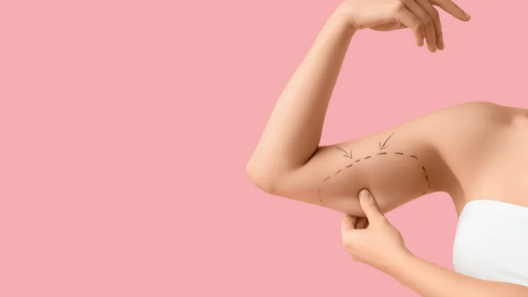 Arm Lift (Brachioplasty): The Most Effective Solution for Sagging Arms