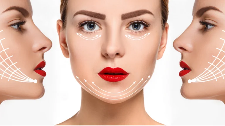 Regain Your Youth with Facelift Surgery